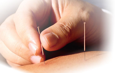 Acupuncture Therapy